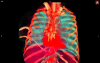 Thorax 10.PNG